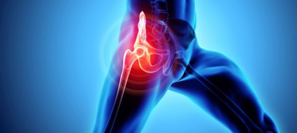 Cost of Hip Replacement Treatment in India