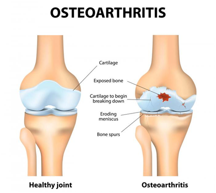 pain in the knee