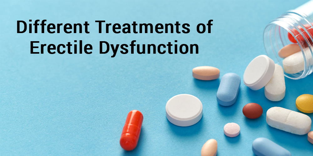 Different Treatments Of Erectile Dysfunction - Aik Designs